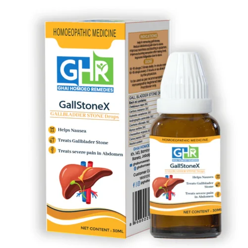 GallStoneX